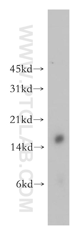 WB analysis of human spleen using 12588-1-AP