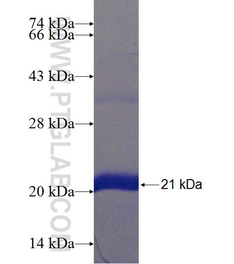 CRABP1 fusion protein Ag19240 SDS-PAGE