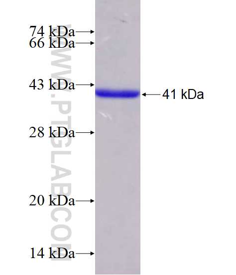CRABP1 fusion protein Ag3291 SDS-PAGE