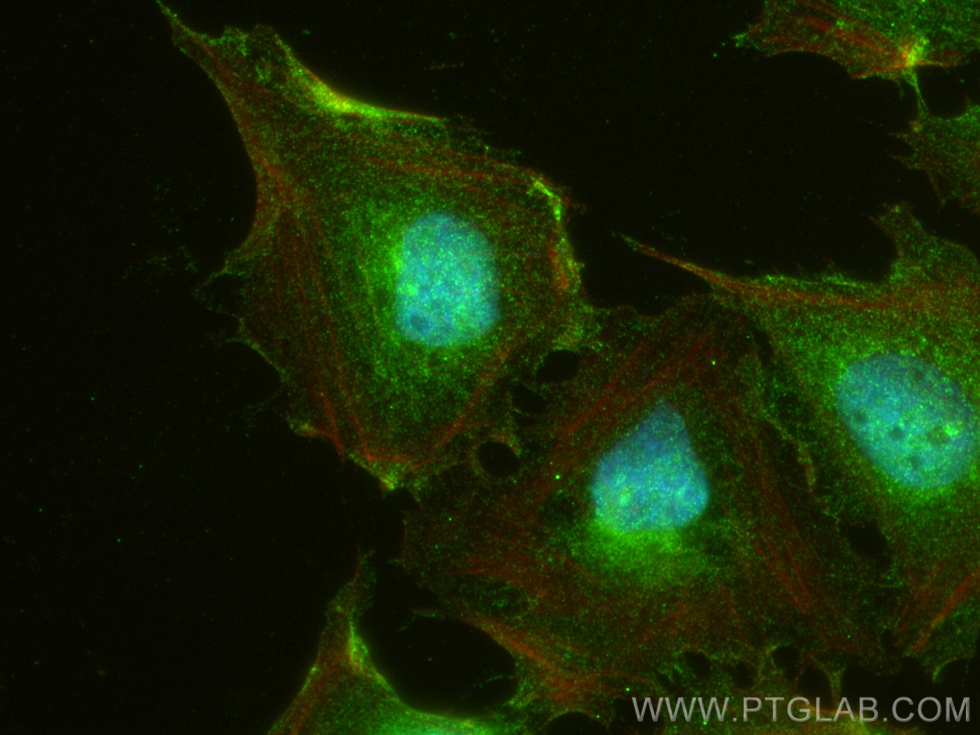 Immunofluorescence (IF) / fluorescent staining of MCF-7 cells using CRABP2 Polyclonal antibody (10225-1-AP)