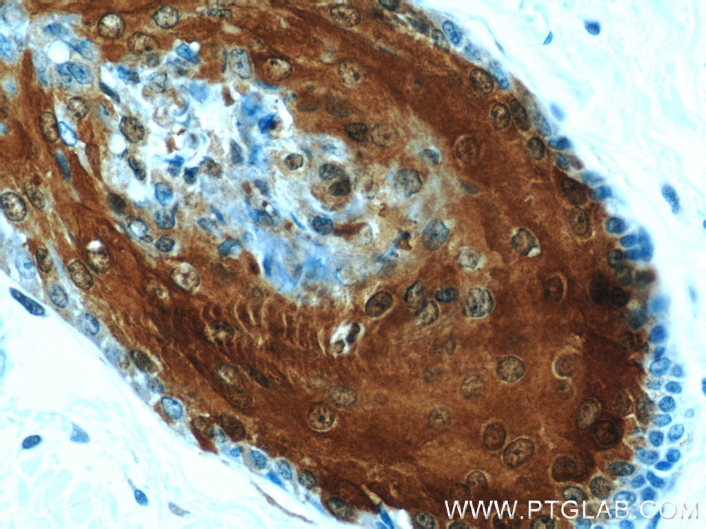 Immunohistochemistry (IHC) staining of human skin tissue using CRABP2 Polyclonal antibody (10225-1-AP)