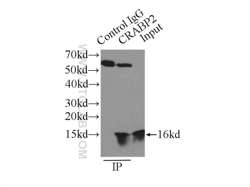 Immunoprecipitation (IP) experiment of HeLa cells using CRABP2 Polyclonal antibody (10225-1-AP)