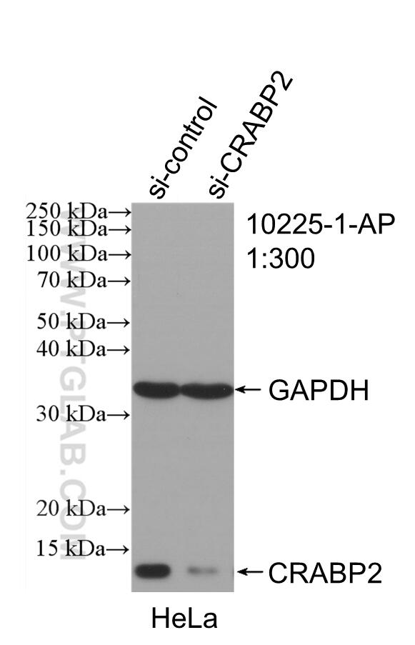 Western Blot (WB) analysis of HeLa cells using CRABP2 Polyclonal antibody (10225-1-AP)