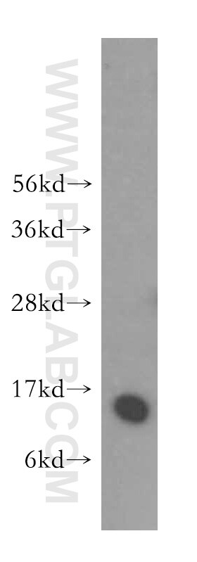 CRABP2 Polyclonal antibody