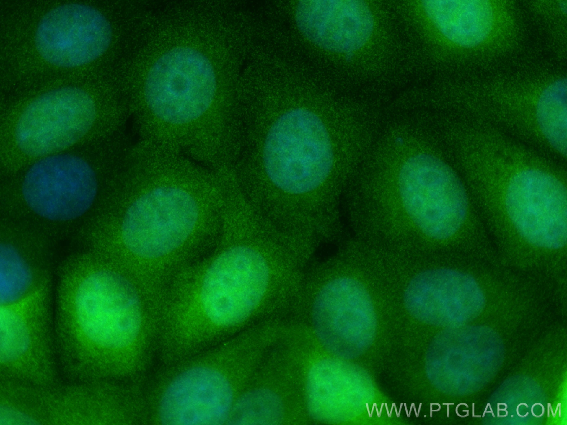 Immunofluorescence (IF) / fluorescent staining of MCF-7 cells using CRABP2 Monoclonal antibody (66468-1-Ig)