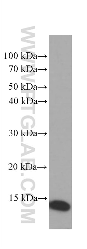 Western Blot (WB) analysis of MCF-7 cells using CRABP2 Monoclonal antibody (66468-1-Ig)