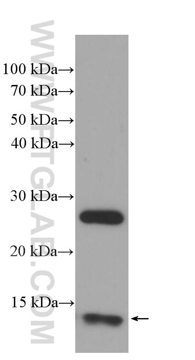 Western Blot (WB) analysis of rat skin tissue using CRABP2 Monoclonal antibody (66468-1-Ig)