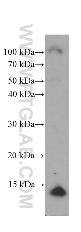 Western Blot (WB) analysis of pig skin tissue using CRABP2 Monoclonal antibody (66468-1-Ig)