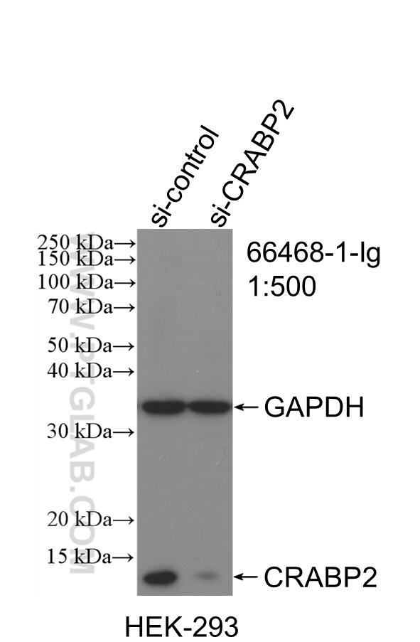 Western Blot (WB) analysis of HEK-293 cells using CRABP2 Monoclonal antibody (66468-1-Ig)