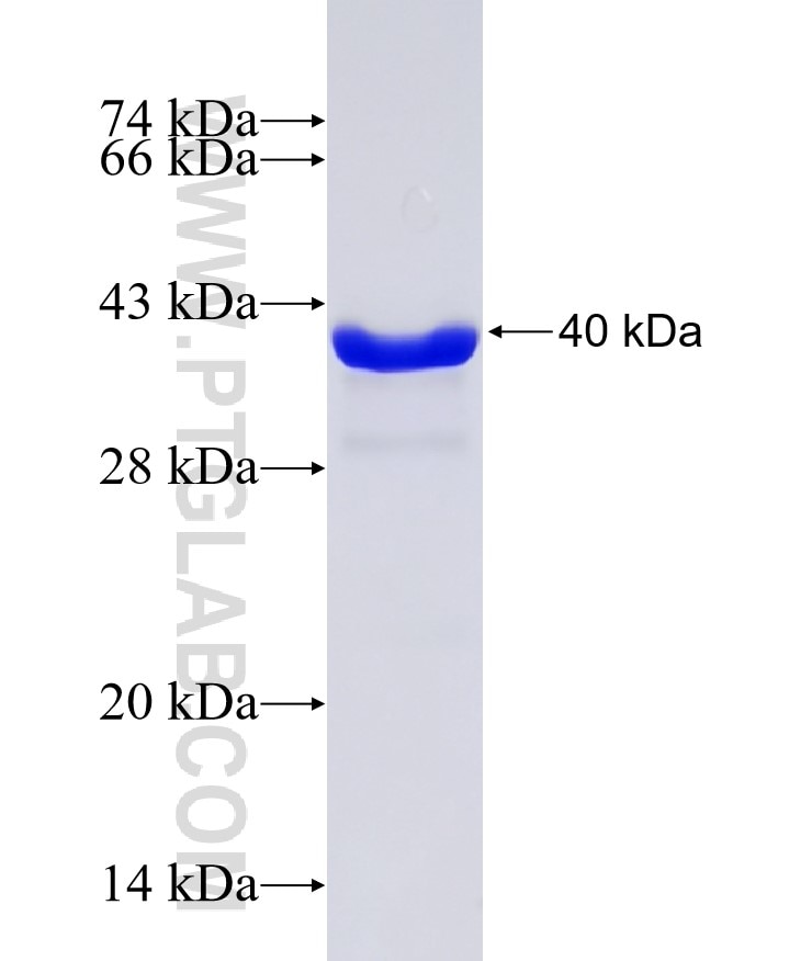 CRABP2 fusion protein Ag0309 SDS-PAGE