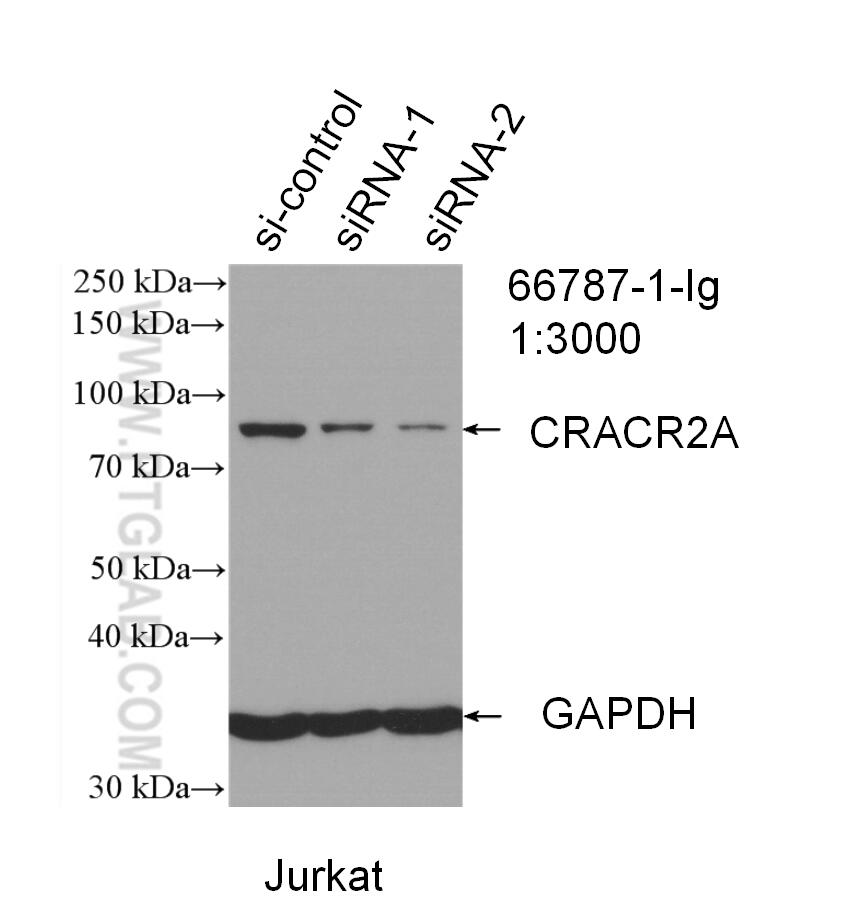 Western Blot (WB) analysis of Jurkat cells using CRACR2A Monoclonal antibody (66787-1-Ig)