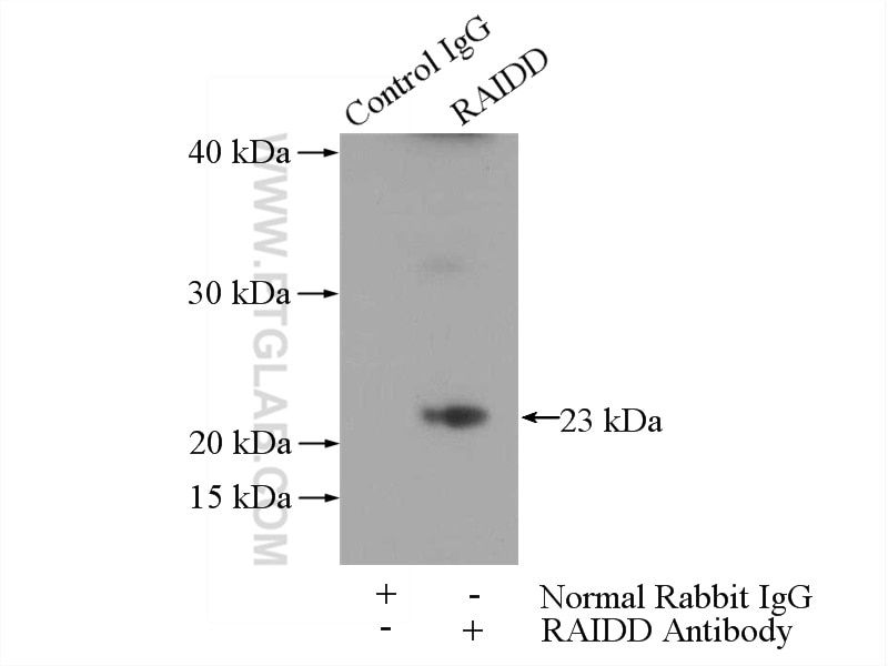 Immunoprecipitation (IP) experiment of mouse kidney tissue using RAIDD Polyclonal antibody (10401-1-AP)