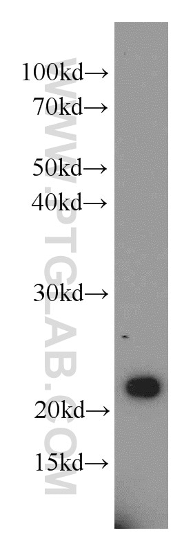 Western Blot (WB) analysis of mouse kidney tissue using RAIDD Polyclonal antibody (10401-1-AP)
