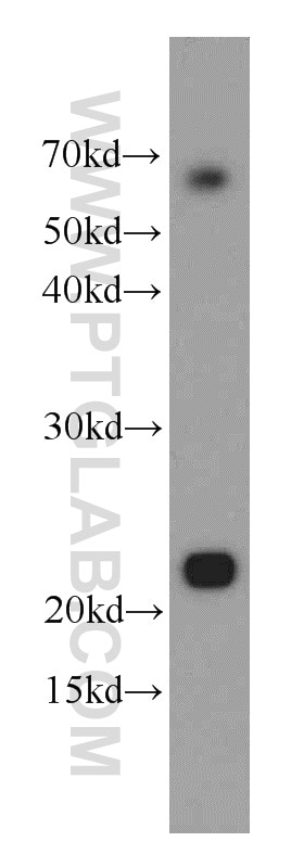 WB analysis of HeLa using 10401-1-AP