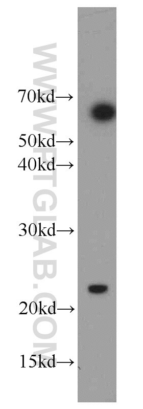 Western Blot (WB) analysis of Raji cells using RAIDD Polyclonal antibody (10401-1-AP)