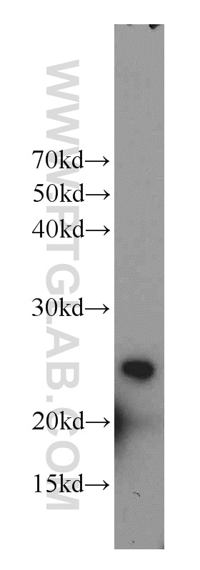 Western Blot (WB) analysis of mouse heart tissue using RAIDD Polyclonal antibody (10401-1-AP)