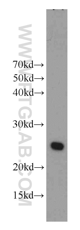 Western Blot (WB) analysis of mouse skeletal muscle tissue using RAIDD Polyclonal antibody (10401-1-AP)