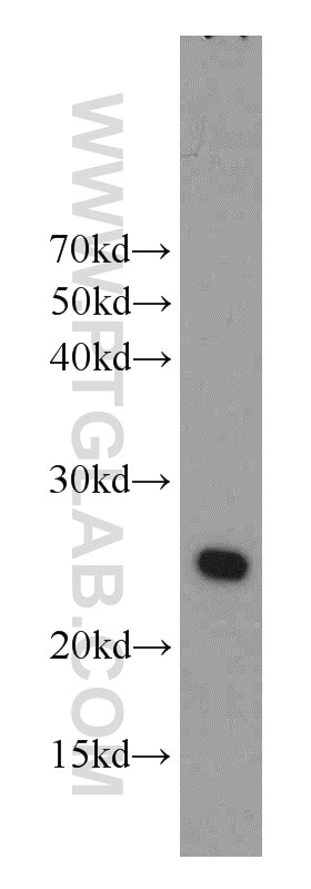 WB analysis of mouse skeletal muscle using 10401-1-AP