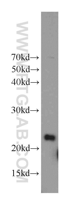 WB analysis of mouse testis using 10401-1-AP