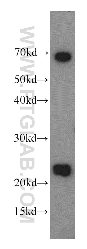 Western Blot (WB) analysis of MCF-7 cells using RAIDD Polyclonal antibody (10401-1-AP)