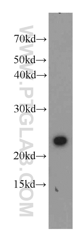Western Blot (WB) analysis of mouse liver tissue using RAIDD Polyclonal antibody (10401-1-AP)