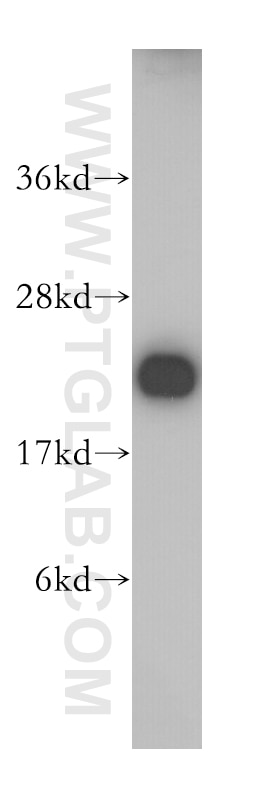 Western Blot (WB) analysis of HEK-293 cells using RAIDD Polyclonal antibody (10401-1-AP)
