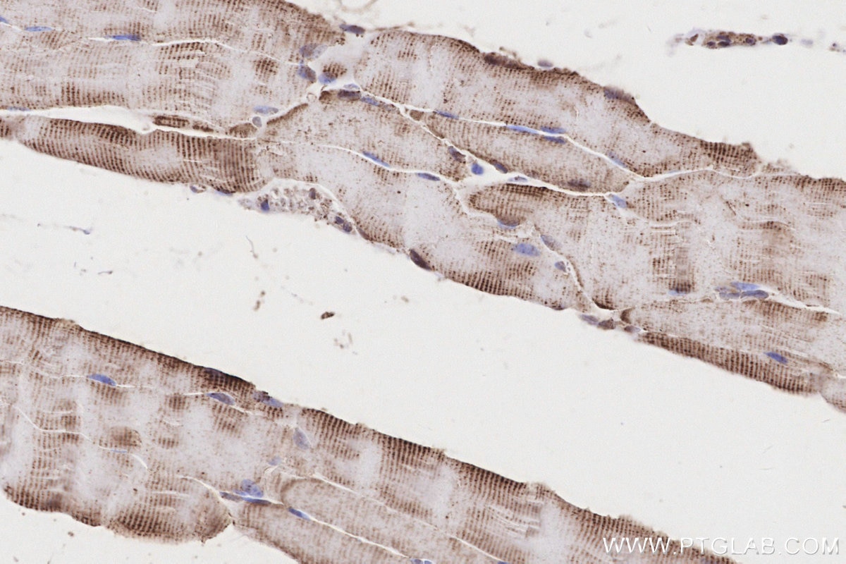 Immunohistochemistry (IHC) staining of mouse skeletal muscle tissue using CRAT Polyclonal antibody (15170-1-AP)