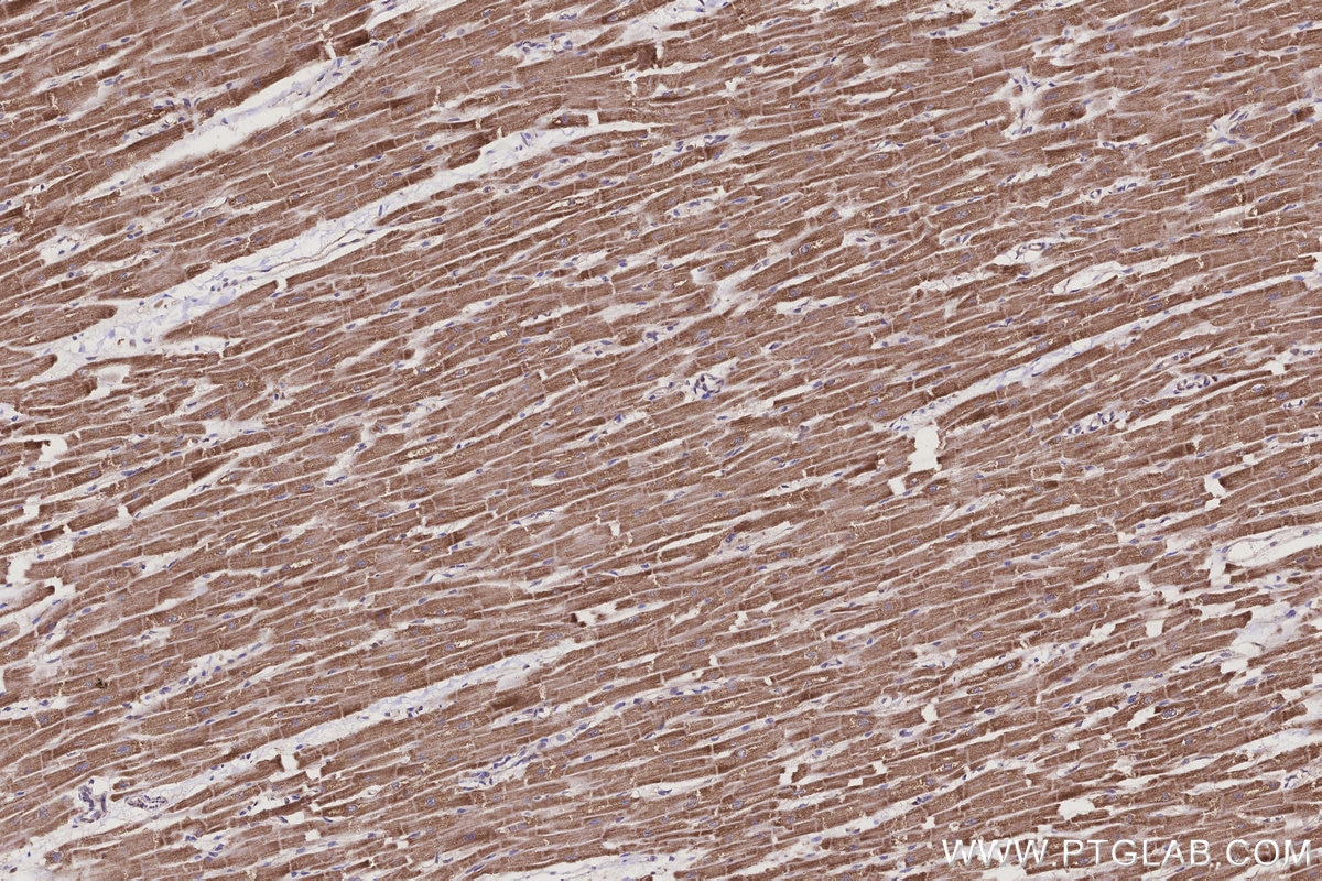 Immunohistochemistry (IHC) staining of human heart tissue using CRAT Polyclonal antibody (15170-1-AP)