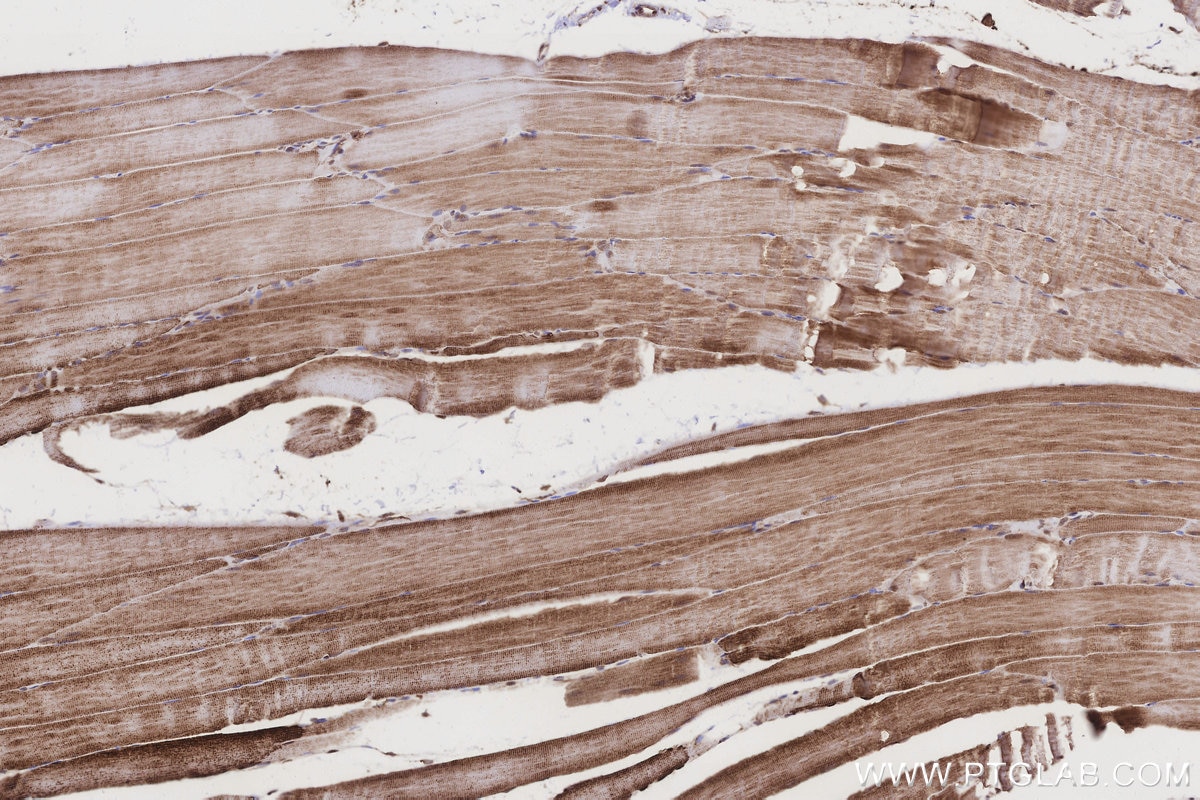 Immunohistochemistry (IHC) staining of rat skeletal muscle tissue using CRAT Polyclonal antibody (15170-1-AP)