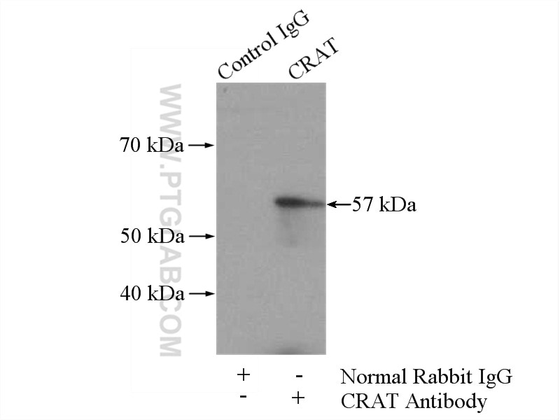 Immunoprecipitation (IP) experiment of mouse skeletal muscle tissue using CRAT Polyclonal antibody (15170-1-AP)