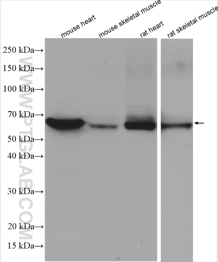 Western Blot (WB) analysis of various lysates using CRAT Polyclonal antibody (15170-1-AP)