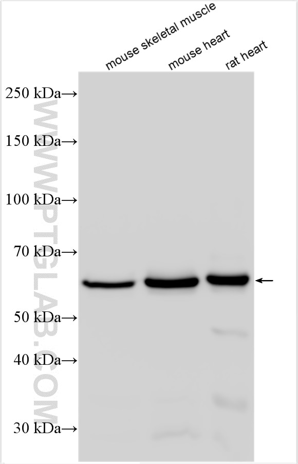 Western Blot (WB) analysis of various lysates using CRAT Polyclonal antibody (15170-1-AP)