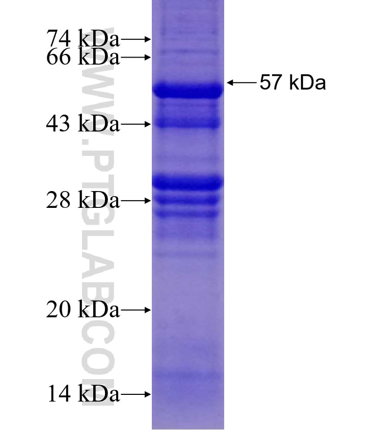 CRAT fusion protein Ag7422 SDS-PAGE