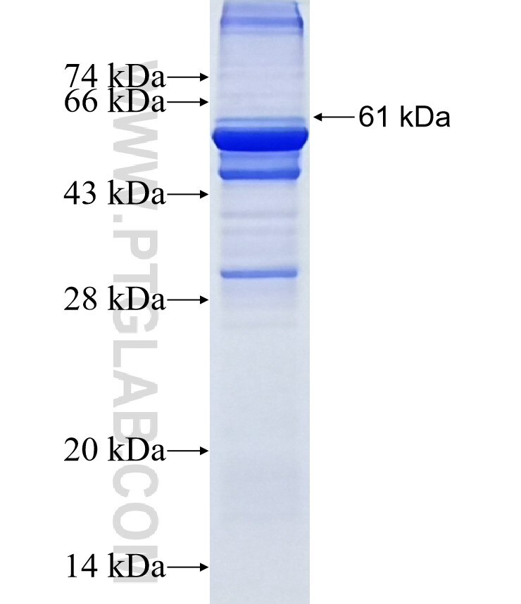 CRAT fusion protein Ag7422 SDS-PAGE