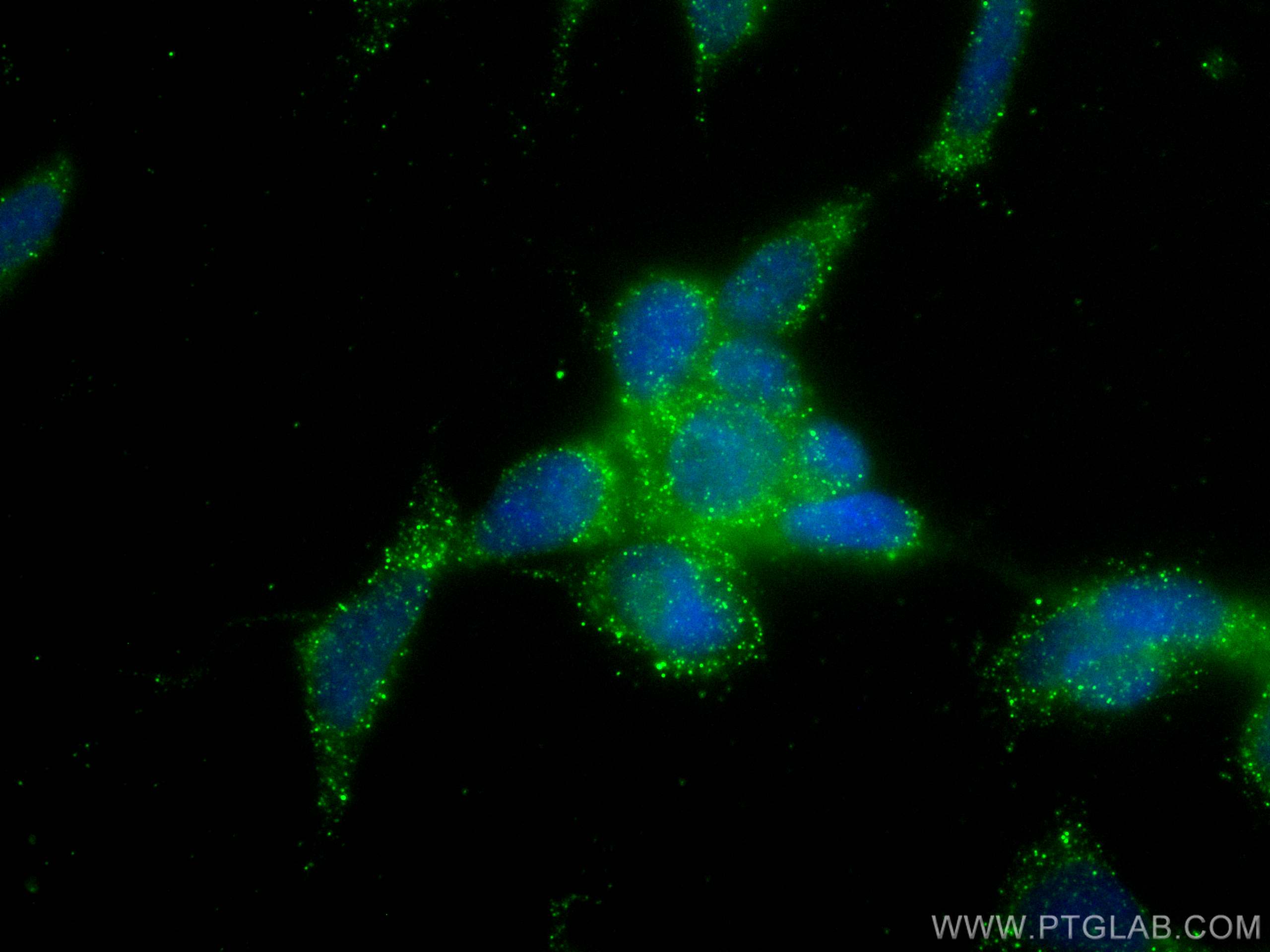 Immunofluorescence (IF) / fluorescent staining of SH-SY5Y cells using CRB1 Polyclonal antibody (26598-1-AP)