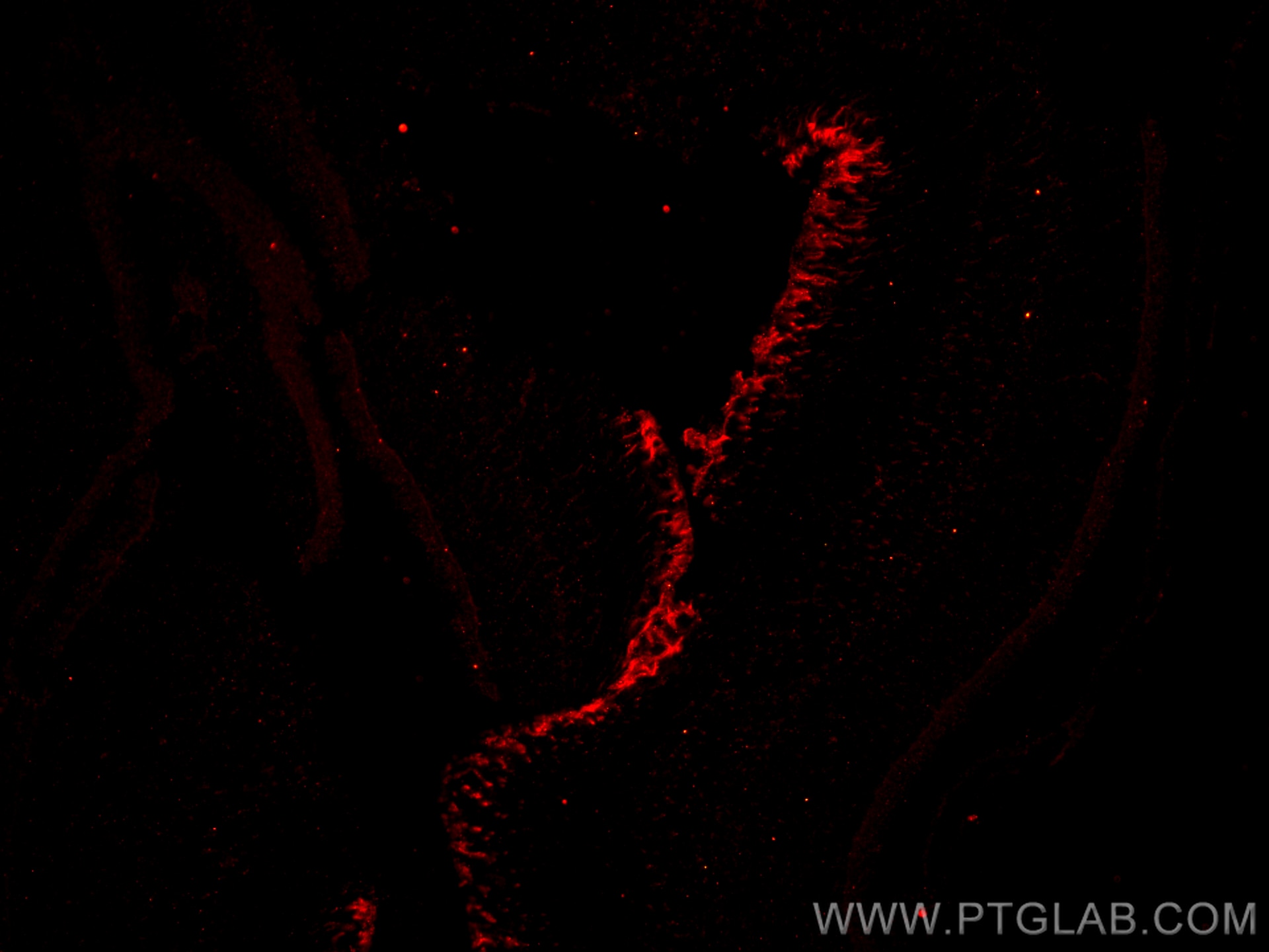 Immunofluorescence (IF) / fluorescent staining of mouse eye tissue using CRB1 Polyclonal antibody (26598-1-AP)
