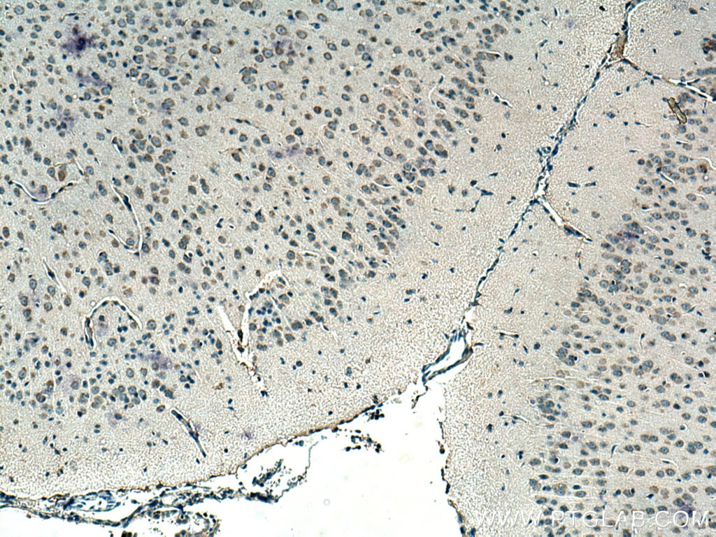 IHC staining of mouse brain using 26598-1-AP