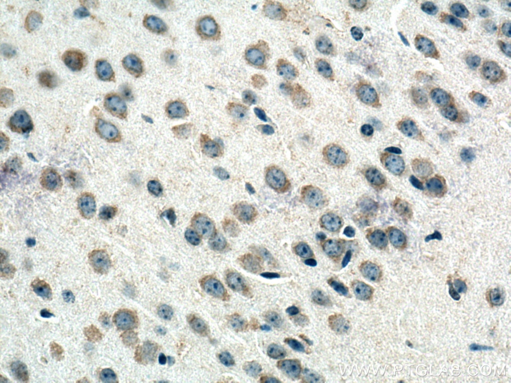 Immunohistochemistry (IHC) staining of mouse brain tissue using CRB1 Polyclonal antibody (26598-1-AP)