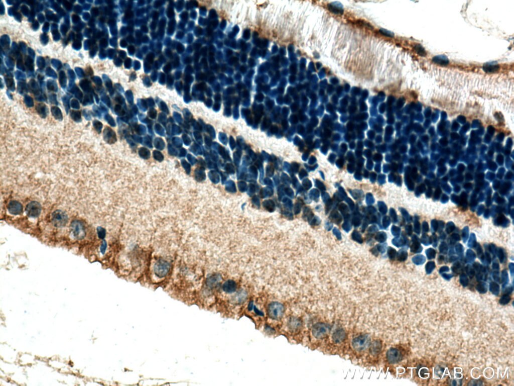 Immunohistochemistry (IHC) staining of mouse eye tissue using CRB1 Polyclonal antibody (26598-1-AP)