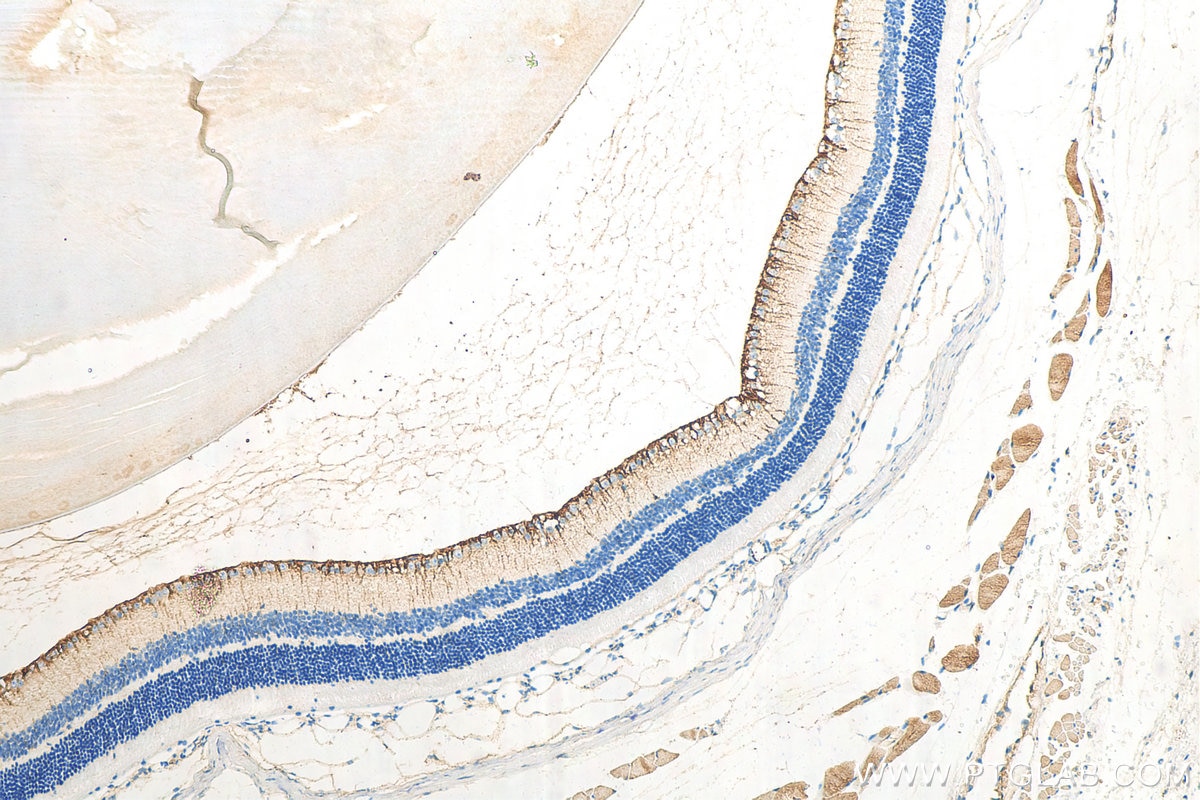 Immunohistochemistry (IHC) staining of mouse eye tissue using CRB1 Polyclonal antibody (26598-1-AP)