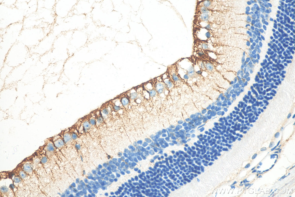 Immunohistochemistry (IHC) staining of mouse eye tissue using CRB1 Polyclonal antibody (26598-1-AP)