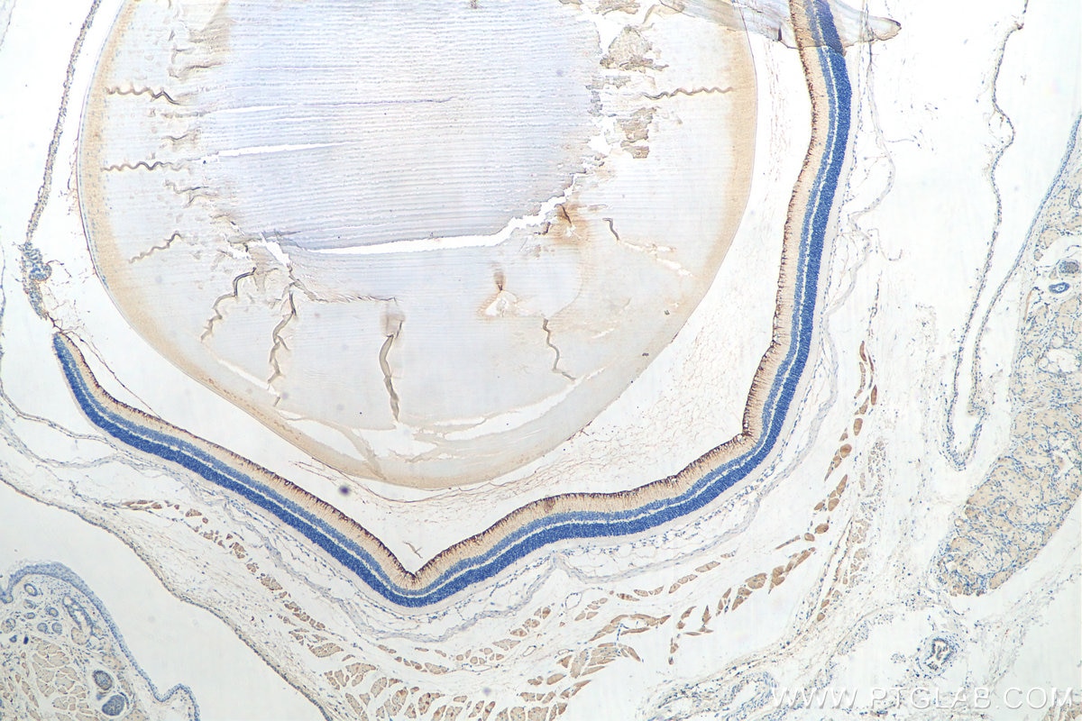 IHC staining of mouse eye using 26598-1-AP