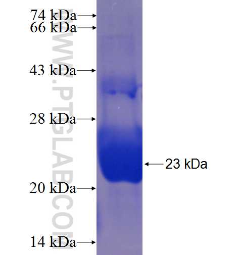 CRB1 fusion protein Ag24139 SDS-PAGE