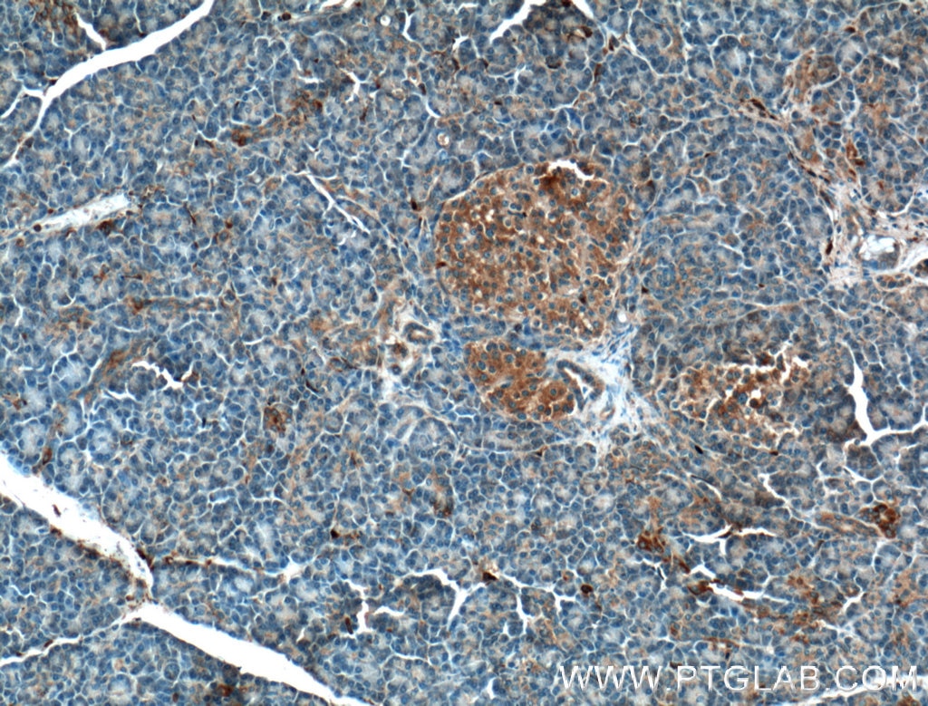 Immunohistochemistry (IHC) staining of human pancreas tissue using CRB3 Polyclonal antibody (12315-1-AP)