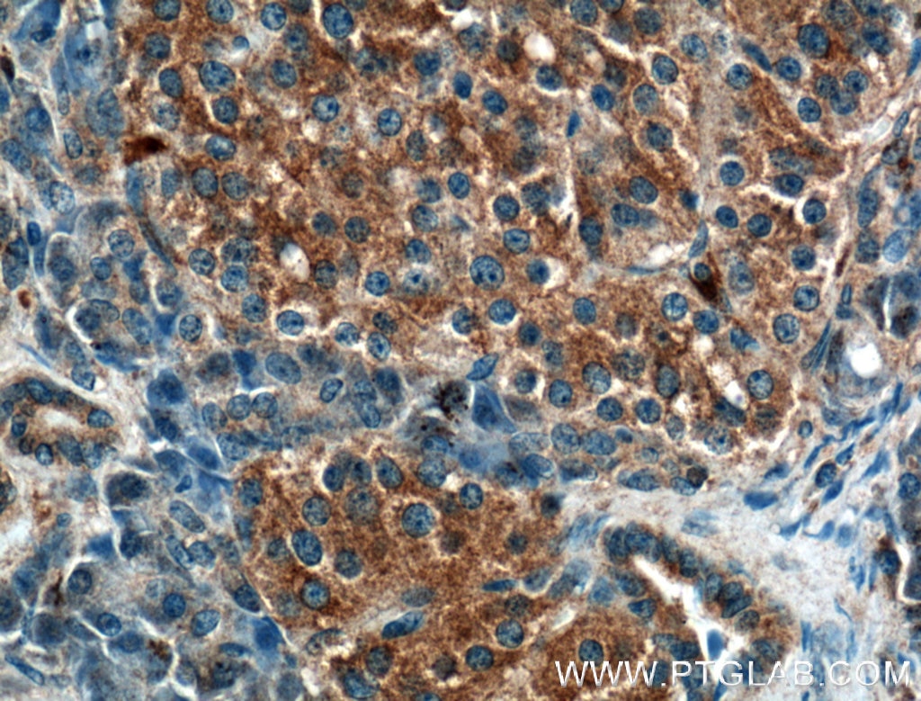Immunohistochemistry (IHC) staining of human pancreas tissue using CRB3 Polyclonal antibody (12315-1-AP)
