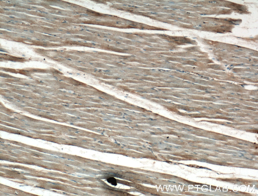 Immunohistochemistry (IHC) staining of human skeletal muscle tissue using CRB3 Polyclonal antibody (12315-1-AP)