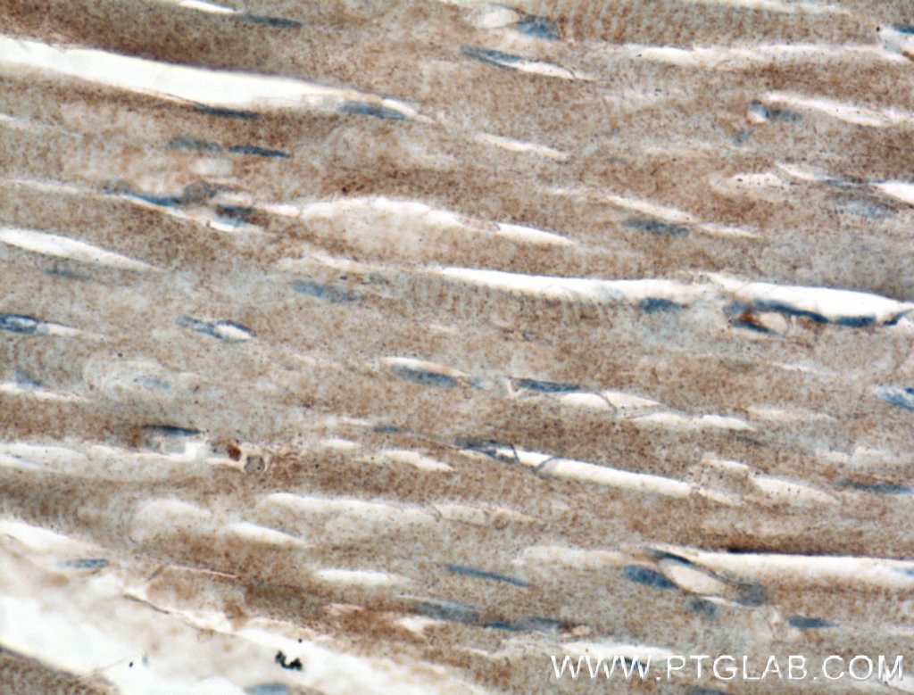 IHC staining of human skeletal muscle using 12315-1-AP