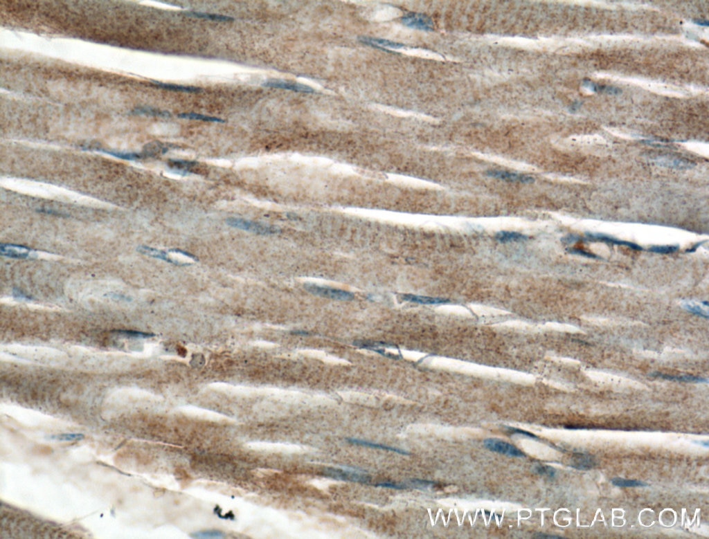 Immunohistochemistry (IHC) staining of human skeletal muscle tissue using CRB3 Polyclonal antibody (12315-1-AP)