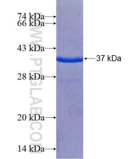 CRB3 fusion protein Ag25981 SDS-PAGE
