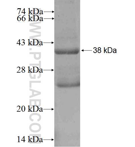 CRB3 fusion protein Ag2968 SDS-PAGE